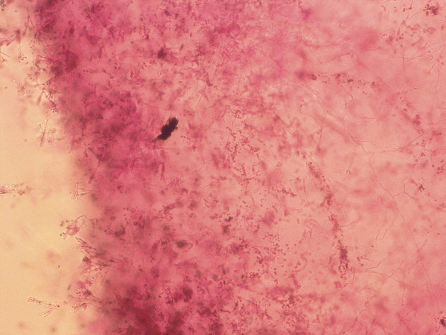 Penicillium Slides - Penicillium 01 400X